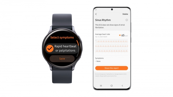 Along with the ECG monitoring feature, Galaxy Watch Active2 will also measure heart pressure. Image: Samsung